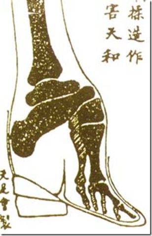 деформация ступней деформация ступней