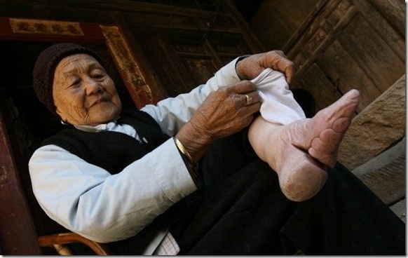 деформация ступней деформация ступней